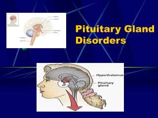 PPT - Pituitary Dwarfism By Emily Owen PowerPoint Presentation - ID:1011186