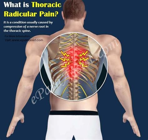 mid to upper back pain causes