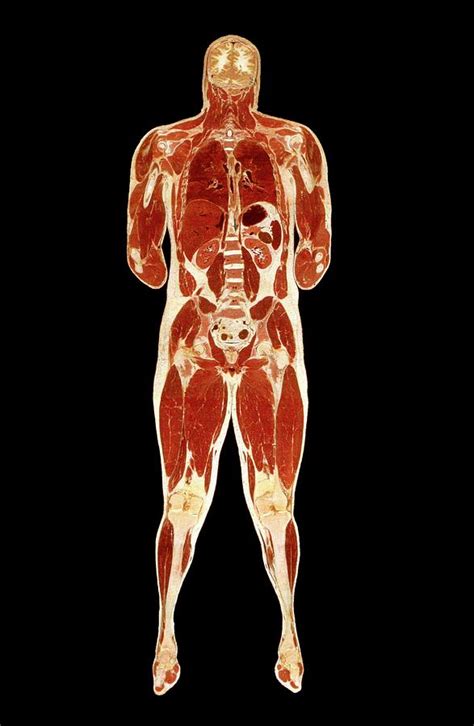 Visible Human Project: Sectioned Male Body (front) Photograph by Science Photo Library - Pixels ...