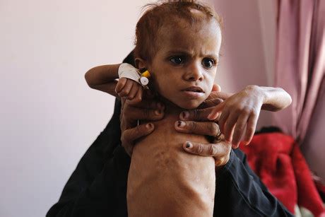 Yemeni Woman Holds Her Malnourished Child Editorial Stock Photo - Stock Image | Shutterstock