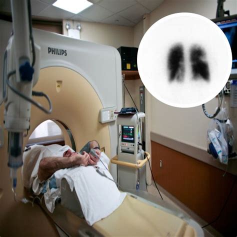 Lung Ventilation Scan | Test Price In Delhi | Cost Near Me, India | Ganesh Diagnostic