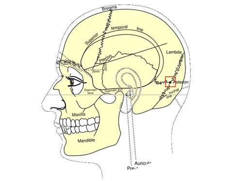 Asterion (anatomy) - Wikipedia | Human skeleton anatomy, Anatomy ...