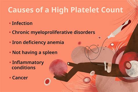 When Should I Worry About Low Platelet Count: Key Insights