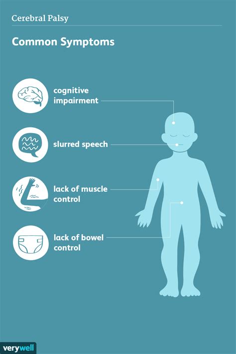 Cerebral Palsy: Signs, Symptoms and Complications