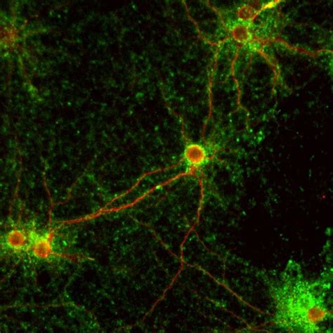 Synaptophysin Antibody (PA1-1043)