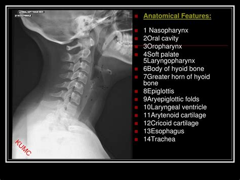 PPT - Soft tissue neck PowerPoint Presentation, free download - ID:6753069