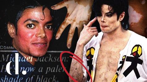 Unveiling The Secrets Behind Michael Jackson's Mysterious Skin Condition