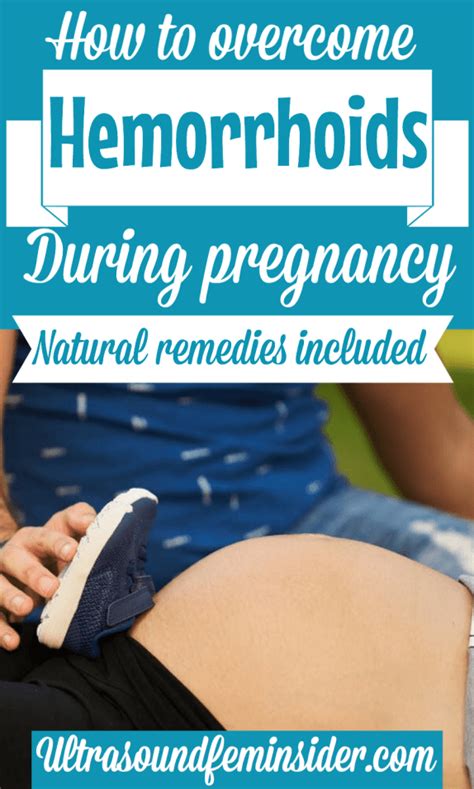 Hemorrhoids during pregnancy, how to prevent and treat them. - Ultrasoundfeminsider