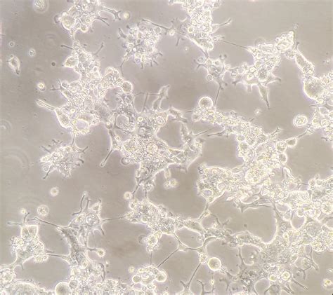 Some 293T cells forming syncytia during lentivirus packaging. : r/labrats