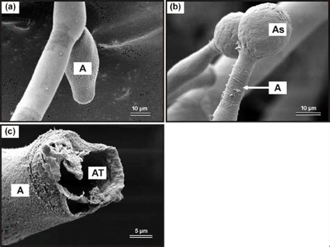 Scanning electron micrograph of a premature ascus (a), ascospore ...