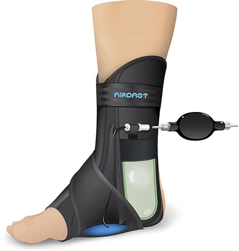 The Flexible Flatfoot in the Adult - Foot and Ankle Clinics