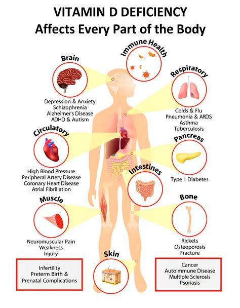 Interactive PDF: How Vitamin D Deficiency Affects Every Part of the ...