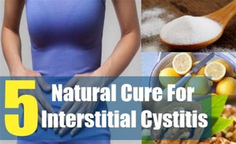 Treatment for Interstitial Cystitis - Philadelphia Holistic Clinic - Dr ...