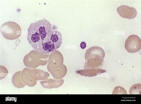 Light micrograph of a normal blood smear showing platelets, a leukocyte ...