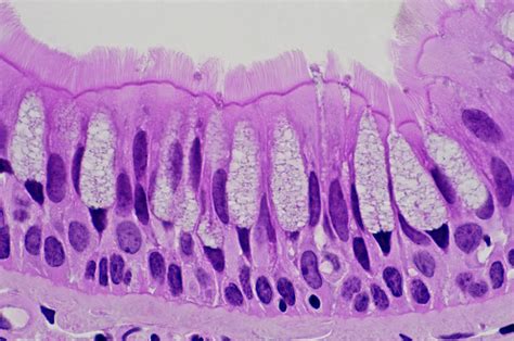 Pseudostratified Columnar Epithelium Histology Histology Slides ...