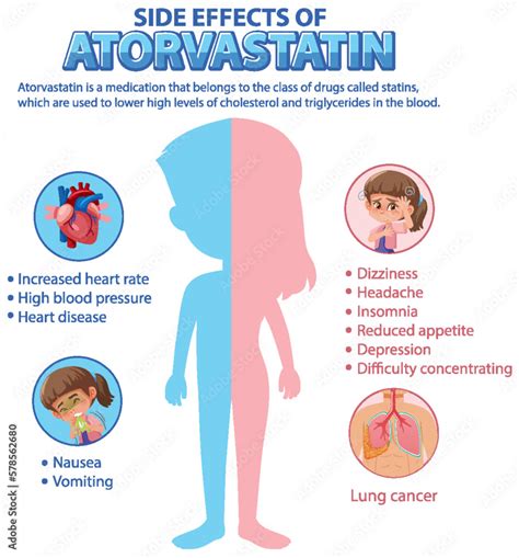 Human anatomy diagram cartoon style of Atorvastatin side effects Stock ...