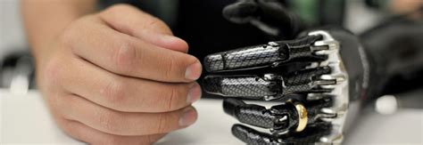 Thought Controlled Bionic Hand Research Receives Funding – Ledbrook Clinic