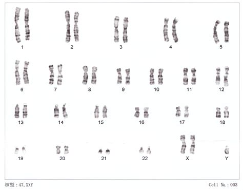 Difference Between Aneuploidy and Polyploidy | Compare the Difference Between Similar Terms