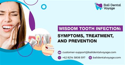 Early Stage Wisdom Tooth Infection, Symptoms, and Treatment