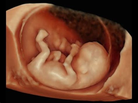 How to Perform 3D Scan of the Baby at 12 Weeks of Pregnancy - YouTube