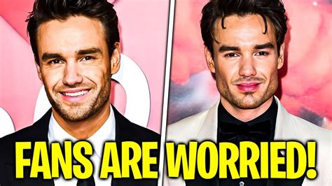 Liam Payne's SHOCKING Plastic Surgery Transformation - Before and After! - YouTube