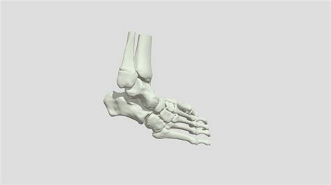 Cavovarus Foot Deformity (S0301) - 3D model by NCHS Cardiac Advanced Projects Lab 3D [bf5ec4f ...