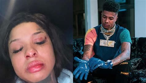 Blueface’s girlfriend Chrisean Rock takes back abuse claims