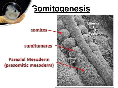 Paraxial and intermediate mesoderm