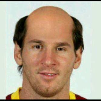 Messi Now With Bald Head - Jokes Etc - Nigeria