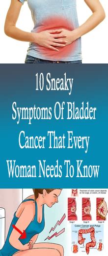 10 Sneaky Symptoms Of Bladder Cancer That Every Woman Needs To Know ...