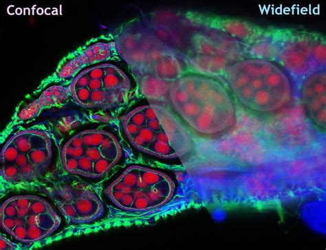 Confocal Microscopy – Illinois State University Advanced Bioimaging ...