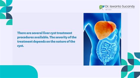 PPT - How Can You Treat a Complex Cyst in Your Liver PowerPoint Presentation - ID:11736083