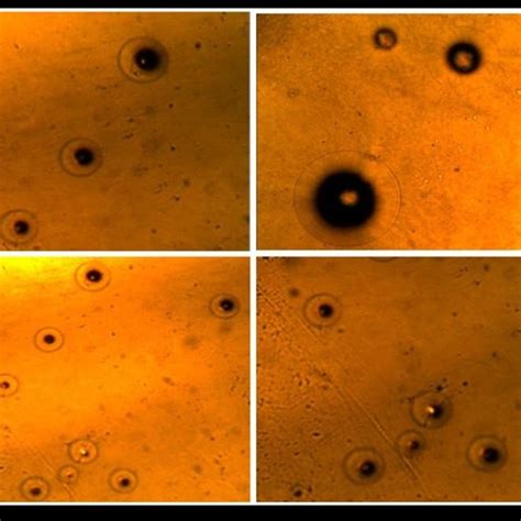 Colonies morphology of Mycoplasma pneumoniae grow Culture agar ...