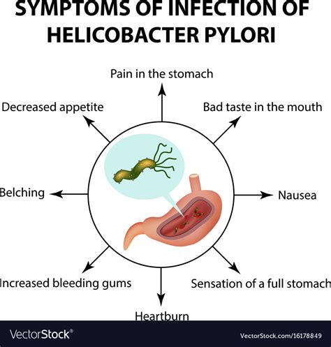 Symptoms infection helicobacter pylori Royalty Free Vector