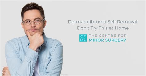 Dermatofibroma Self Removal: Don’t Try This at Home – Centre for Minor Surgery