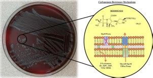 Clinical and economic impact of meropenem resistance in Pseudomonas aeruginosa–infected patients ...