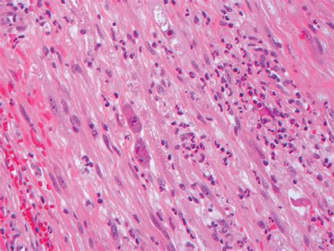 Neuropathology | Basicmedical Key