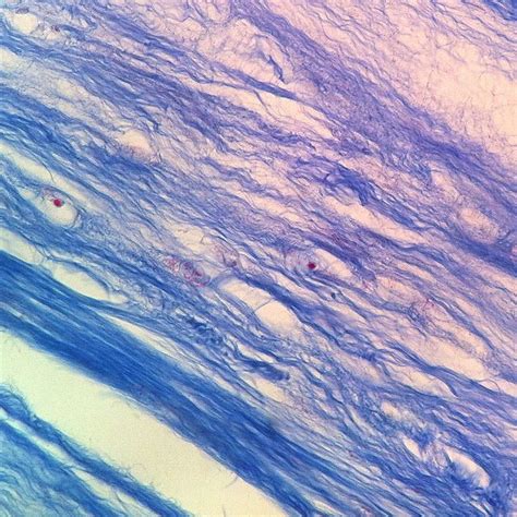 Fibrocartilage Histology