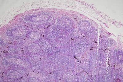 Histology-World! Histology Fact Sheet-Lymph Nodes