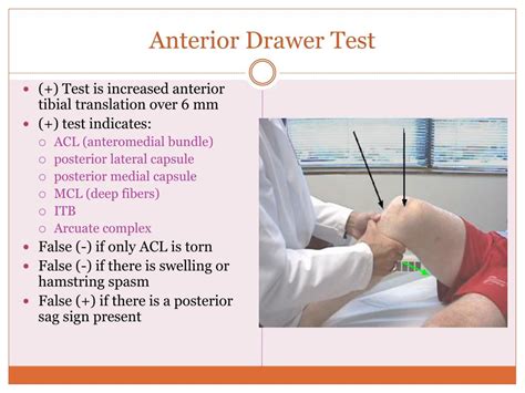 Anterior Drawer Test