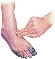 Diabetic Foot and Neuropathy | Smith's Shoes