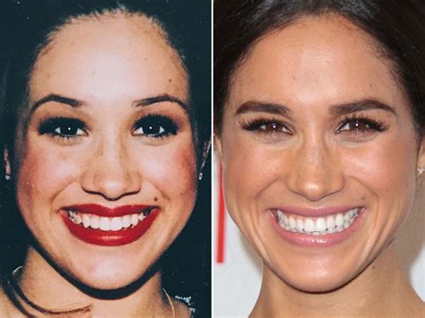 Meghan markle before and after – Artofit