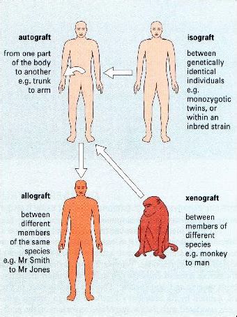 Autografts vs Xenografts vs Allografts - OpenWetWare