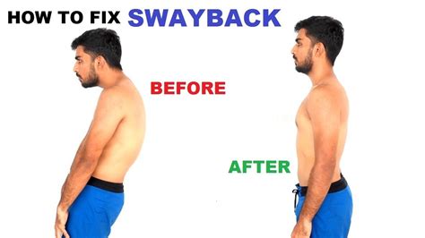 Swayback Exercises