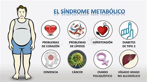 Causas Del Sindrome Metabolico