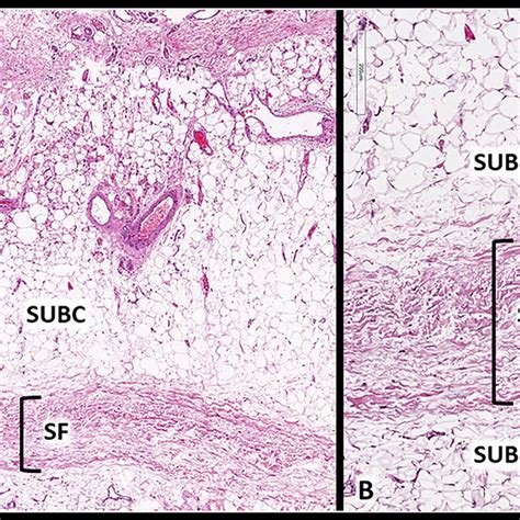 Histology of the superficial fascia. Superficial fascia (SF) is a thin ...