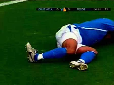 Worst Soccer Injuries Of All Time