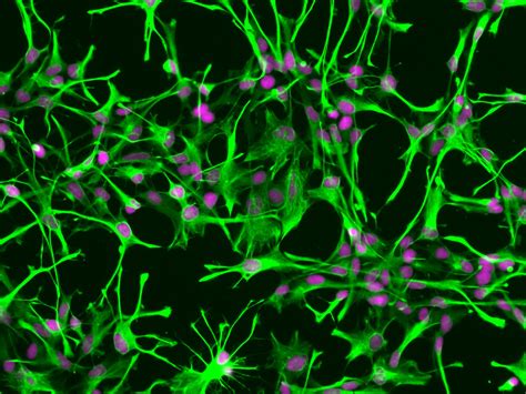 Cell Culture Media Archives - ScienCell Research Laboratories