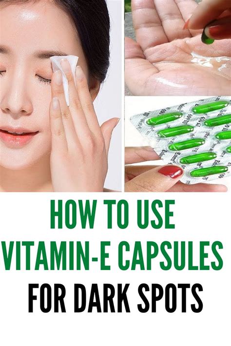 Benefits Of Vitamin E Capsules | How To Use For Skin and Hair ...