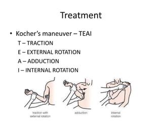 Kocher Maneuver Shoulder